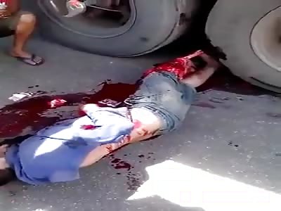 Accident  man loser leg