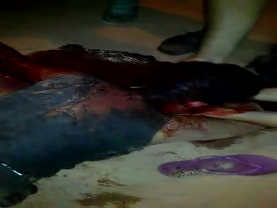 Woman agonizing after shot