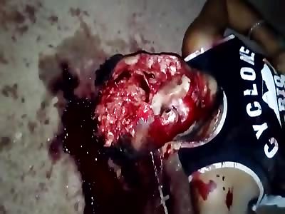 Man with a head blown by a big caliber