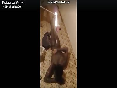 African Muslim tortured with burnt plastic