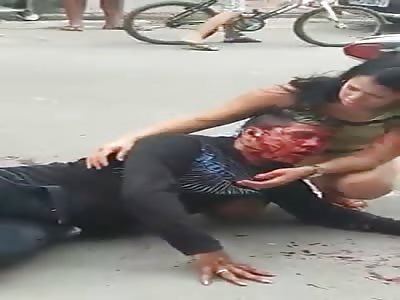 Thief agonizing after shot by police