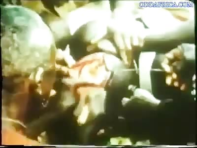 Brain Surgery The Old African way