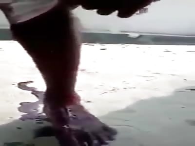 African man shot in the leg by the army for loving trump