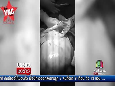 woman had an alien growing inside of her