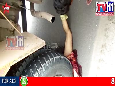 man killed by a lorry the police pull of his legs