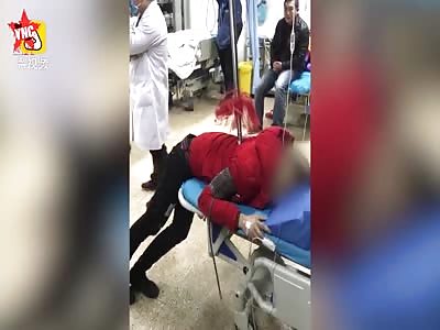a man has 2 meter Hong Ying gun stuck in his back in Huangshan