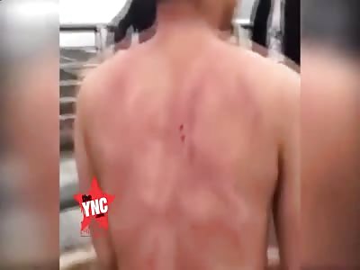  bridegroom brutally suffers by his own friends