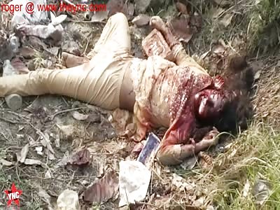 Girl Deformed by Stoning after Sexual Assault