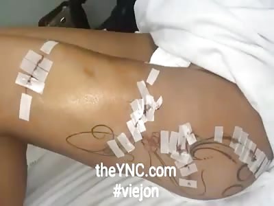 Images of strong tattoo infecion