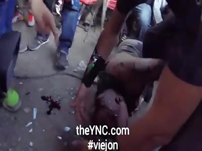 Fighter bleeds from head to head