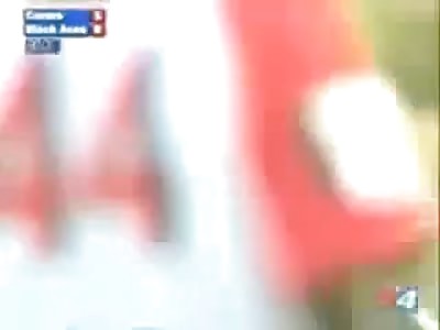 Horrible injury he bends his leg to player