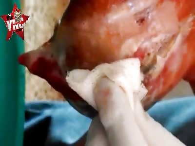 Cleaning deep wound by motorcycle accident