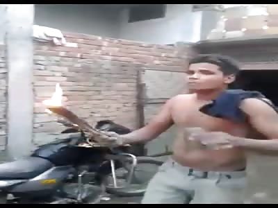 Lunatic burns the face