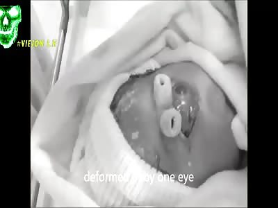 Photo gallery anomalies