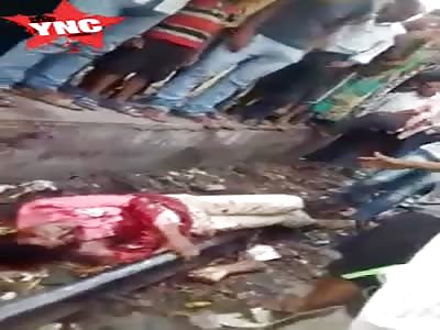 Mans arm was cut off by a train