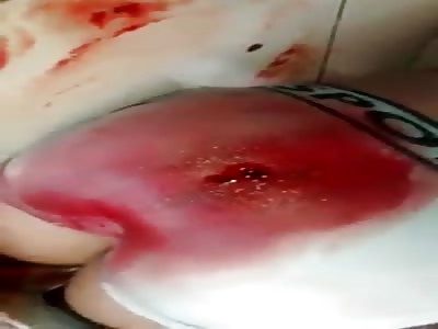 Thug got shot in the ass