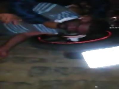 Man got his neck stuck on a motorbike chain