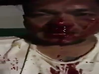 Bloodied Thief Slapped for Stealing a Chicken