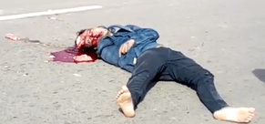 Accident Leaves Man with a Crushed Head