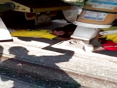 Kids Leg Got Torn Up Under Trucks Wheels