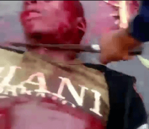 Massacred Africans Corpses Brutally Stabbed and Mutilated