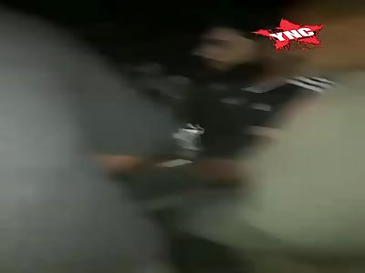 Injured by explosion