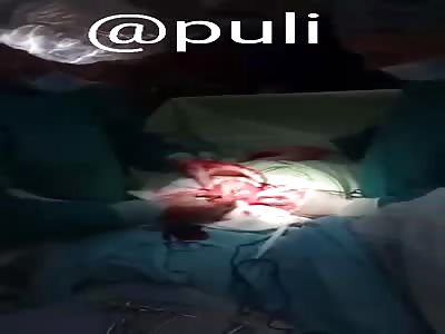 Oh shit!!  operation to extract, big dildo that puli got in the ass