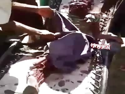 12-year-old boy seriously injured, victim of bombings