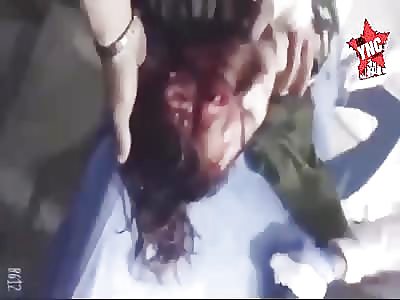 Protester killed by head shot