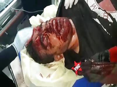 Seriously injured after accident