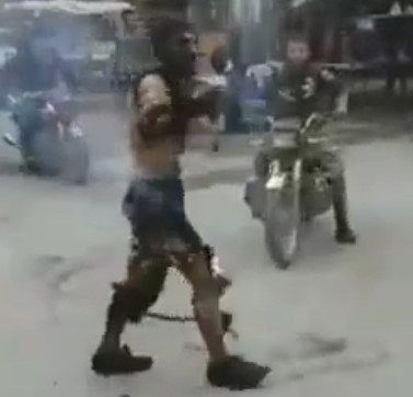 Man Walking Around With Body Totally Burned after Explosion in Afrin