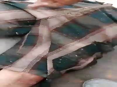 Man in agony for getting shot