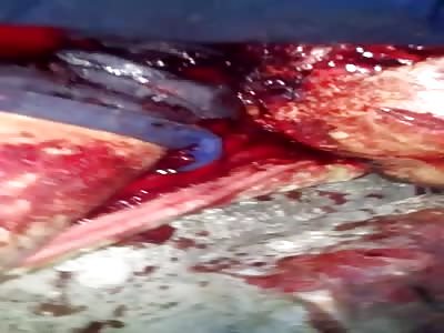  killer inside your house