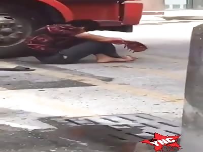 seriously injured hand after accident