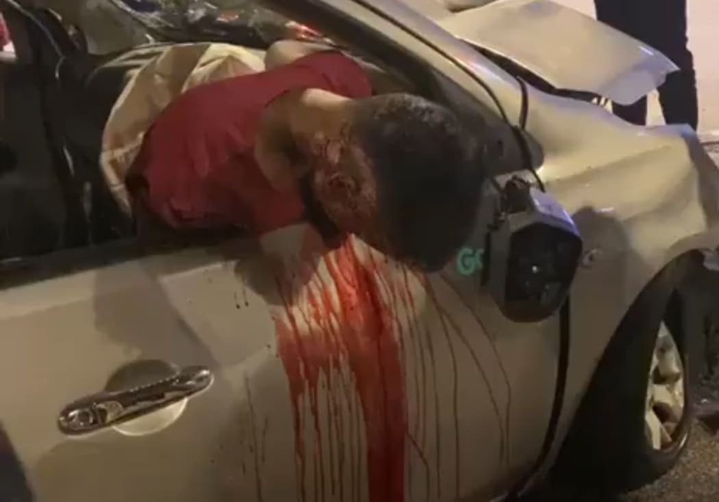 Head Leaking After Road Accident