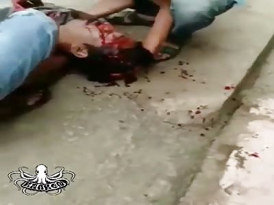 man shot dead and hacked with machete