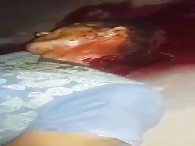  with big cut on the neck