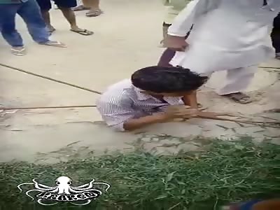 Guy Impaled by Iron Rods at Work