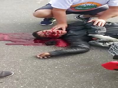 victim of terrible motorcycle accident