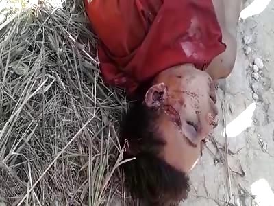 Seriously injured, with knife.