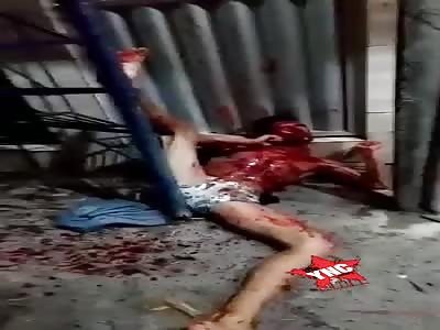 BRUTAL: Shot Dude Slowly Dies Outside His House.