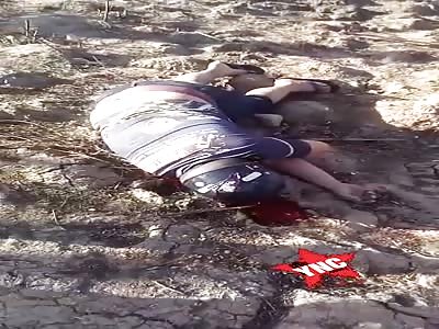 Man shot in the head