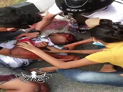 Young victims of motorcycle accident