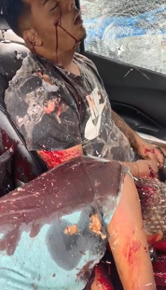 Machine Gun Massacre in Brazil