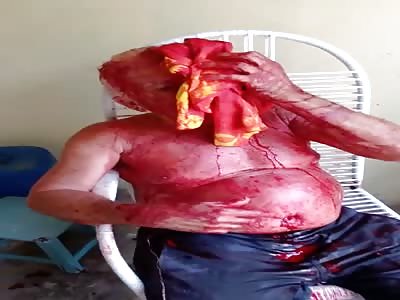 Oh man, what did you do to get that done to you