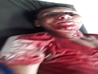 Friend but what happened to you?