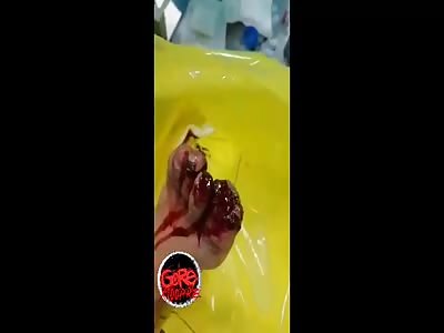 Ouch man that must hurt