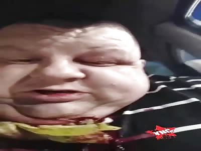 Taxi driver is cut in the throat by thieves