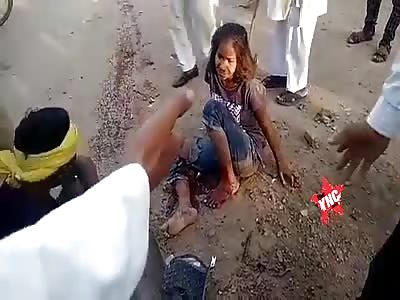 The girl was run over