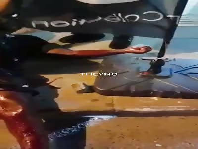  in agony after getting ripped off